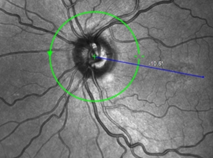 Retina Realm