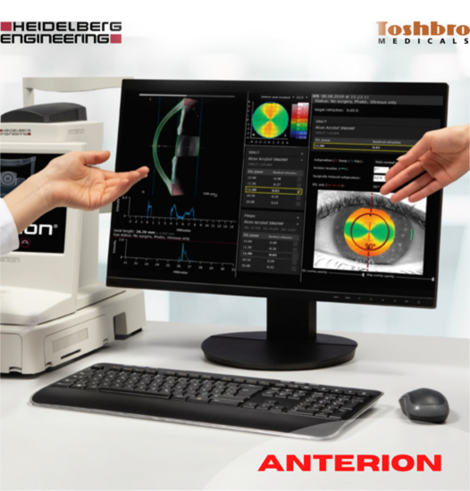 Toshbro Medicals brings to you Anterion® from Heidelberg Engineering.