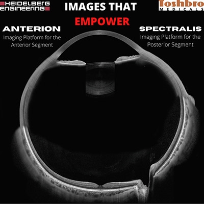 Visualize the whole eye based on multimodal high-resolution OCT technology.