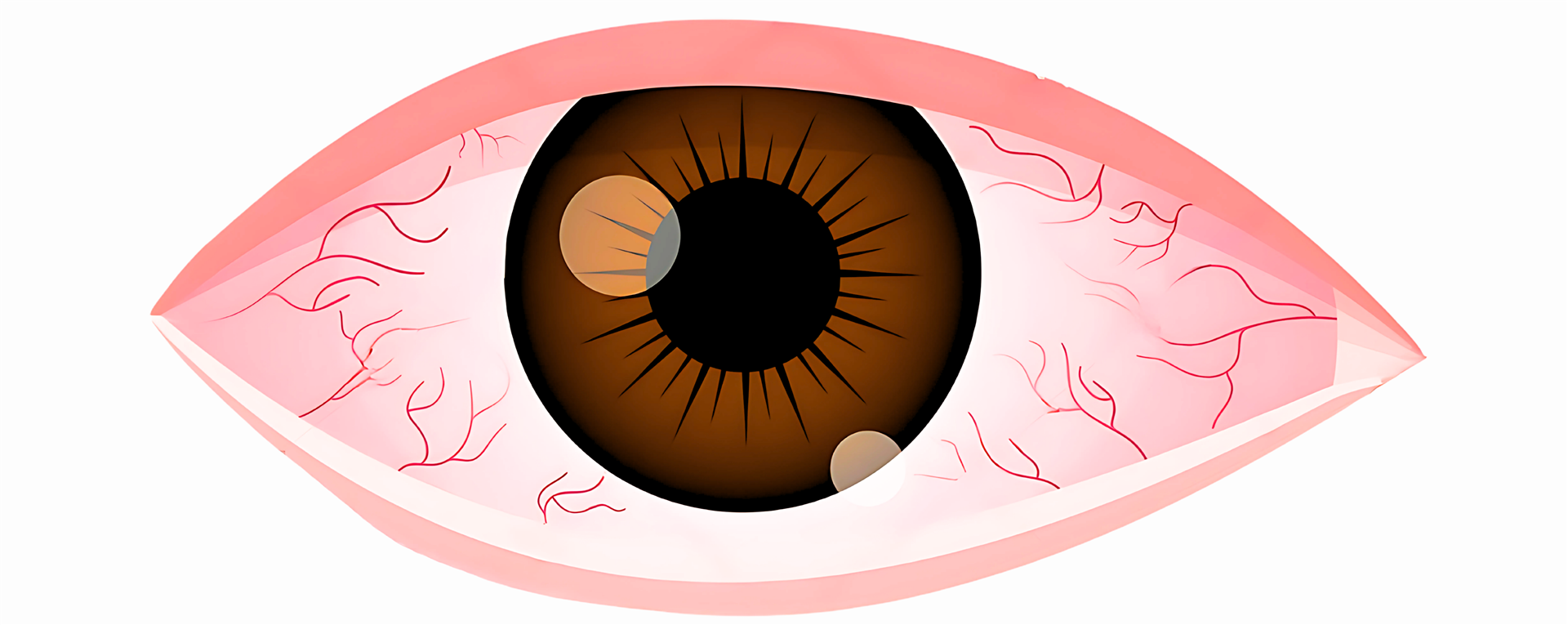Dry Eye Screening & Treatment System