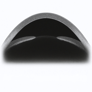 Anterior Segment Imaging