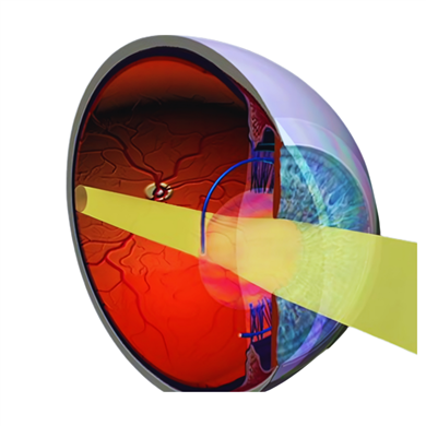 General Ophthalmic Diagnostics & Examination