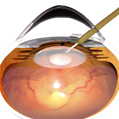 Phacoemulsification & Vitrectomy Systems