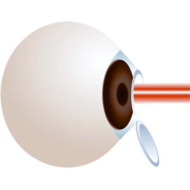 Refractive & Therapeutic Systems
