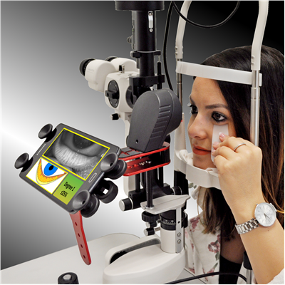 Me-Check : MGD Screening System